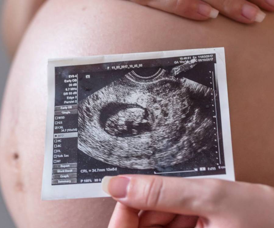 Relacionan la contaminación del aire con cambios en el desarrollo cerebral fetal